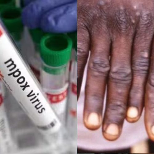 भारत ने बनाई स्वदेशी Monkeypox Detection RT-PCR Kit: वैश्विक स्वास्थ्य संकट में बड़ी उपलब्धि